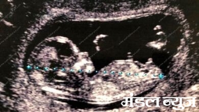 Unborn-Baby-Amravati-Mandal