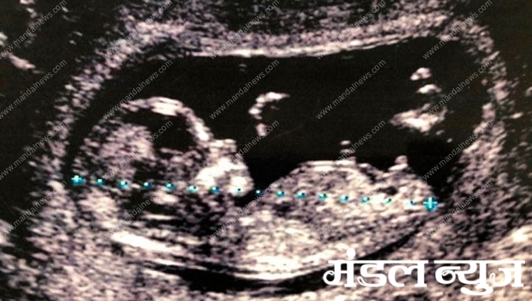 Unborn-Baby-Amravati-Mandal