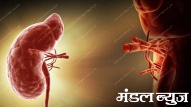 kidney-implant-amravati-mandal