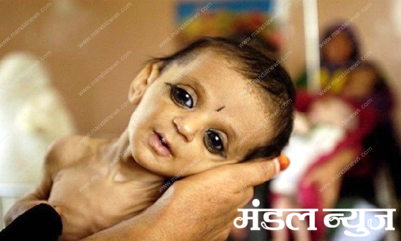 malnutrition-amravati-mandal