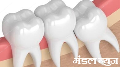 teeth-amravati-mandal